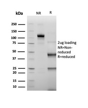 Recombinant ERG (Vascular Endothelial & Prostate Marker) Antibody