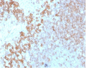 CD27 Antibody