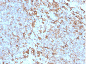 CD27 Antibody