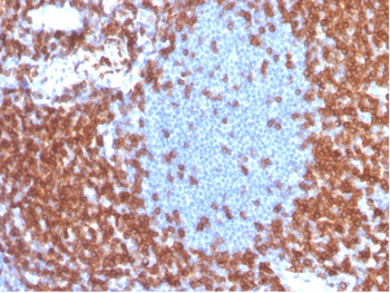 Recombinant CD3e (T-Cell Marker) Antibody