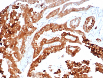 HAVCR2 Antibody
