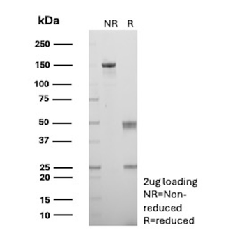 CALD1 Antibody