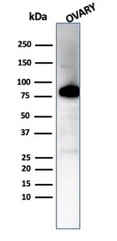 CALD1 Antibody