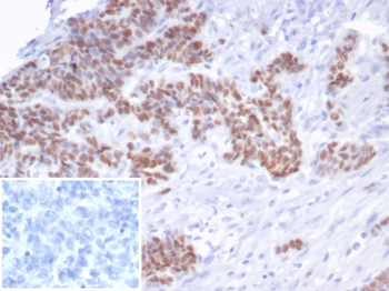 TP53 Antibody