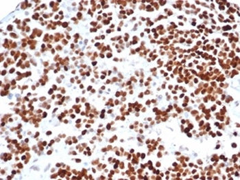 TP53 Antibody