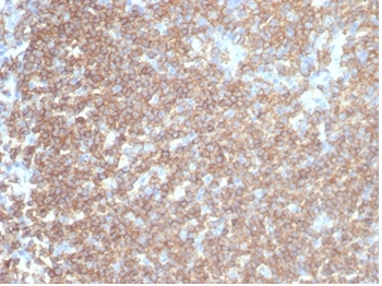 PTPRC Antibody