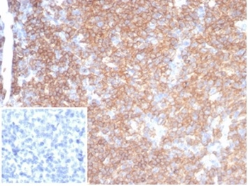 PTPRC Antibody