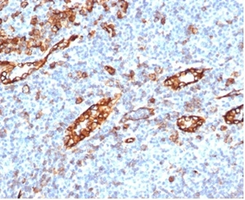 Recombinant CD31 / PECAM-1 (Endothelial Cell Marker) Antibody