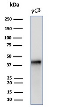 SERPINB5 Antibody