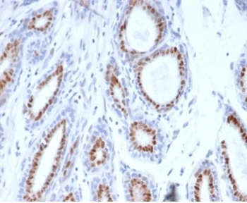 PGR Antibody