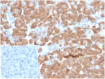 RPSA Antibody