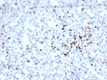Recombinant Granzyme B (NK/T-Cell Lymphoma Marker) Antibody