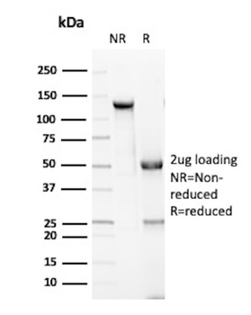 Recombinant Granzyme B (NK/T-Cell Lymphoma Marker) Antibody