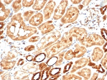 AKR1B1 Antibody
