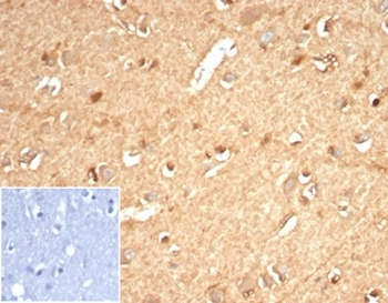 AKR1B1 Antibody