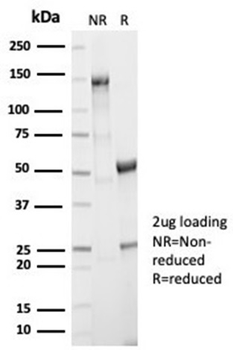 AKR1B1 Antibody