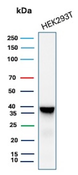 AKR1B1 Antibody