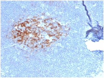 CD23 (Fc Epsilon RII) Antibody