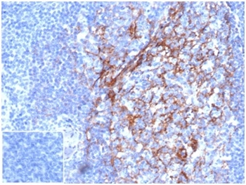 CD23 (Fc Epsilon RII) Antibody