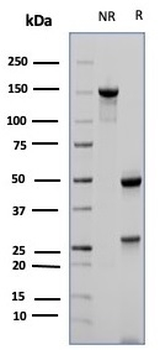 CD23 (Fc Epsilon RII) Antibody