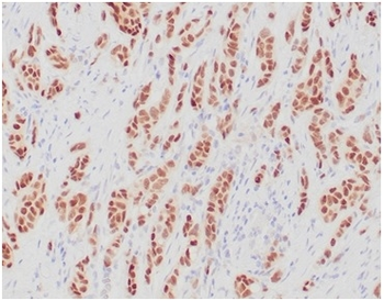 ESR1 Antibody