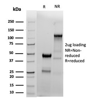 ESR1 Antibody