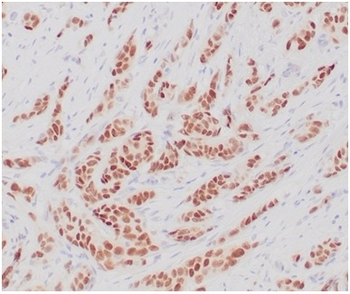 ESR1 Antibody