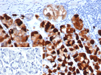 CKB Antibody
