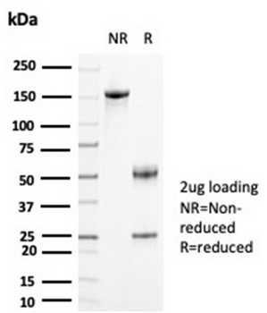 CKB Antibody