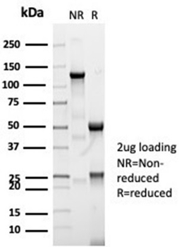 CFTR Antibody