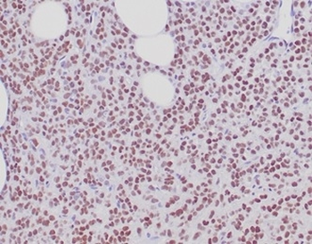 ESR1 Antibody