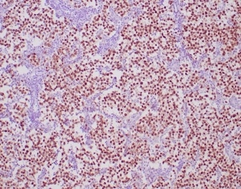 POU5F1 Antibody
