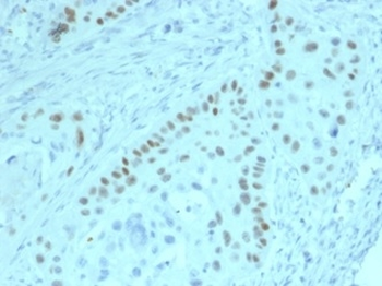 TP63 Antibody
