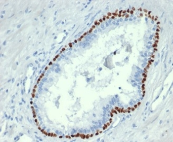 TP63 Antibody