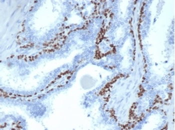 TP63 Antibody