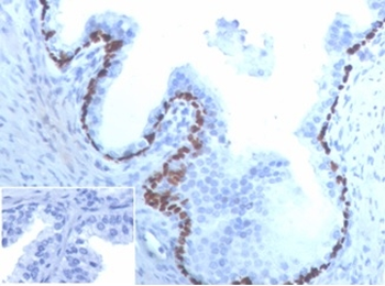 TP63 Antibody
