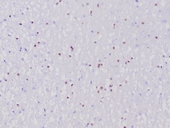 Recombinant OLIG2 (Marker of Glial Brain Tumors) Antibody
