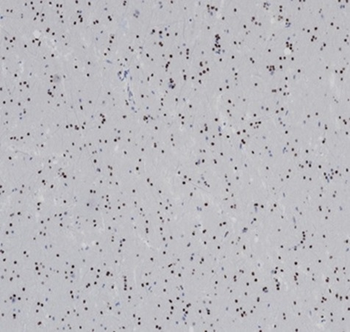 Recombinant OLIG2 (Marker of Glial Brain Tumors) Antibody
