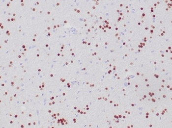 Recombinant OLIG2 (Marker of Glial Brain Tumors) Antibody