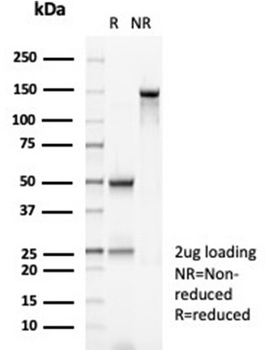 MSH2 Antibody