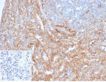 ICAM1 Antibody