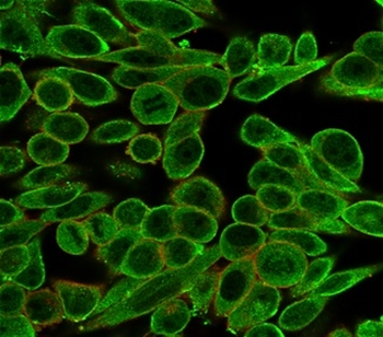 MED21 Antibody