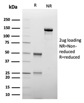HAVCR2 Antibody