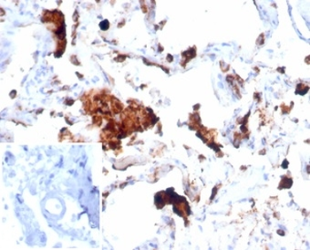 NAPSA Antibody
