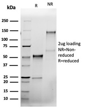 Recombinant Bcl-X (Apoptosis Marker) Antibody