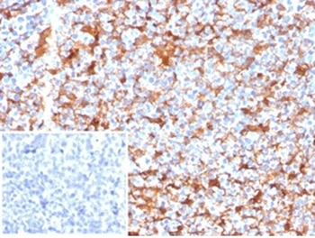 FSCN1 Antibody