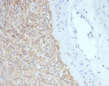 KIT Antibody