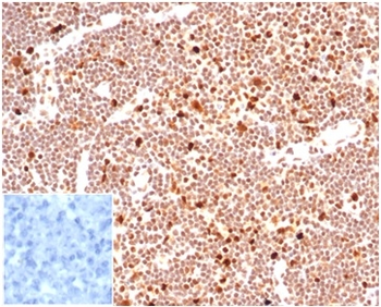 PCNA (Proliferating Cell Nuclear Antigen) (G1- & S-phase Marker) Antibody