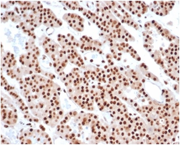 PCNA (Proliferating Cell Nuclear Antigen) (G1- & S-phase Marker) Antibody