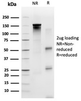 SP100 Antibody